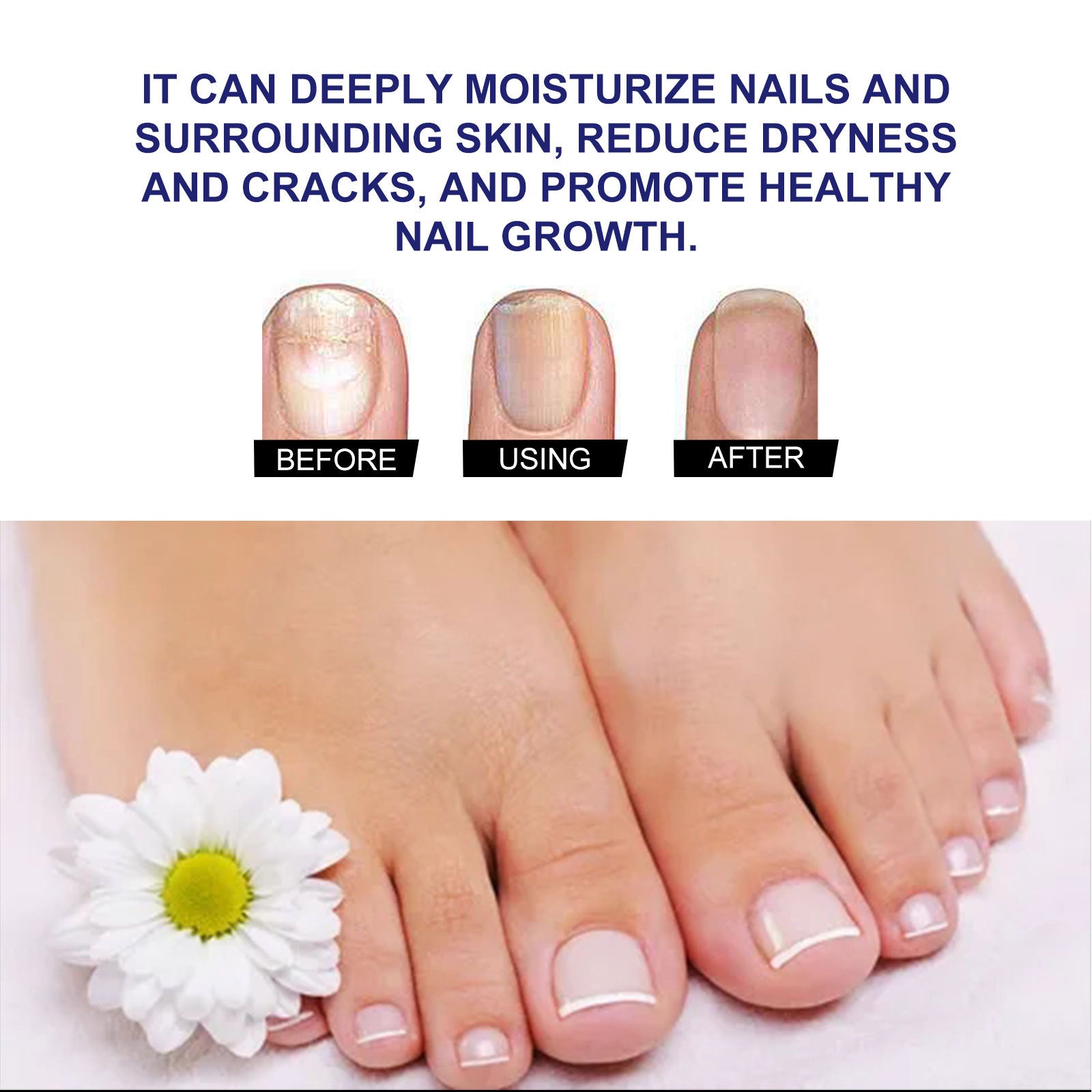Nail Care Solution Repair Hand And Foot Soft Nail Thickening Bright Nail